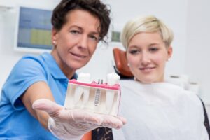 Dentist holding a dental implant model 